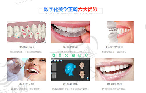 数字化正畸优势