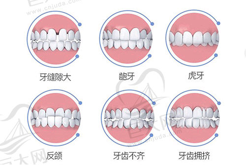 正畸适用人群