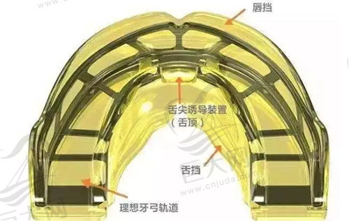 mrc矫治器