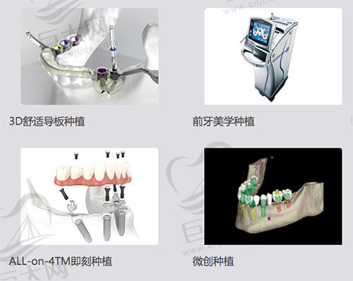 苏州美奥口腔种植技术