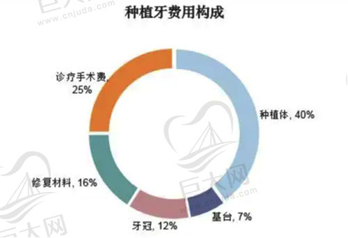 种植牙费用构成