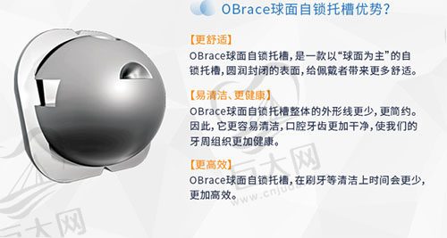 obrace球面自锁托槽优势