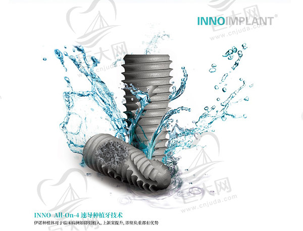 韩国inno伊诺种植牙