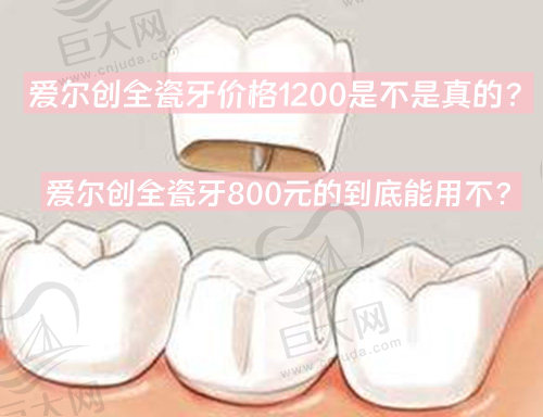 爱尔创全瓷牙价格1200是不是真的