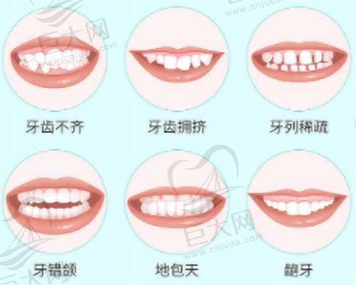 需要正畸情况