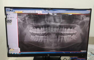 广州六月微笑口腔