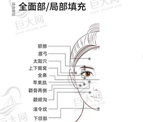 面部脂肪可填充部位