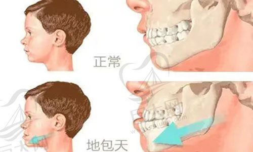 对比详细示意图