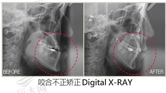 李真秀--韩国菲斯莱茵整形外科代表院长