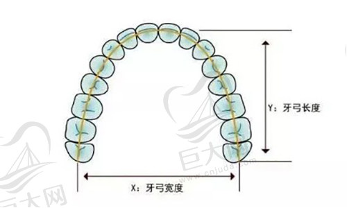 扩弓