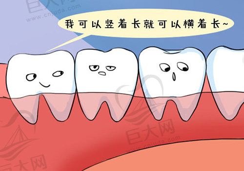 智齿生长随意