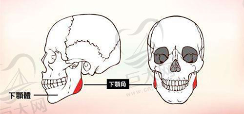 下颌角整形