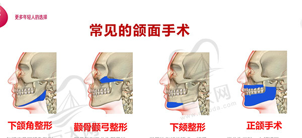 广东韩妃柳超医生磨骨怎么样