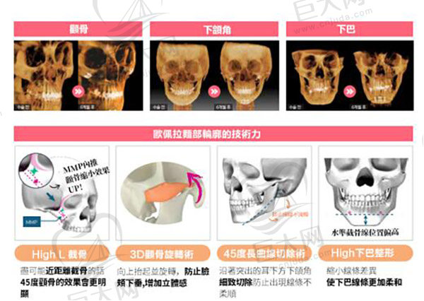 韩国欧佩拉整形外科