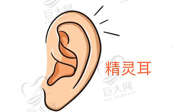 回答网友提问精灵耳整形多少钱呢？精灵耳整形是长久的吗