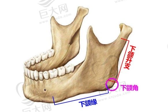 下颌角手术