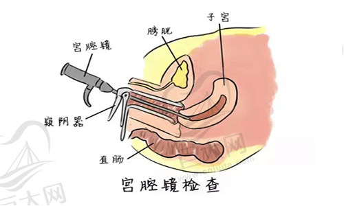 私密整形