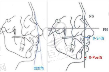 成都艺星鼻整形