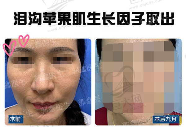 北京郭鑫取生在因子怎样