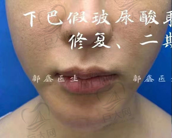 怎么知道自己注射的是不是生长因子