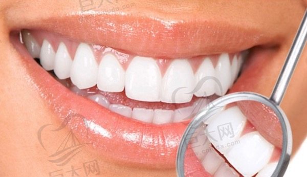 牙齿美白有哪些方法