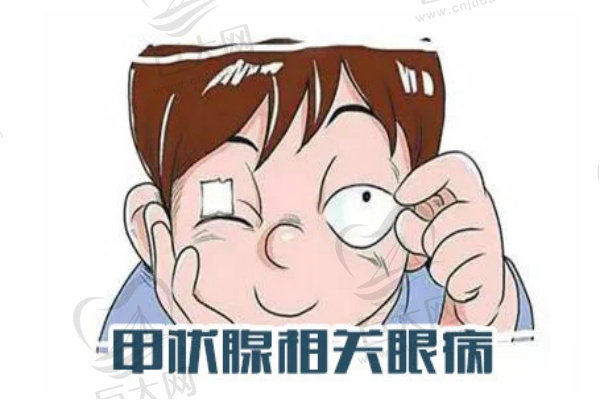 甲状腺引起凸眼