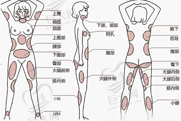 冯庆亮吸脂技术