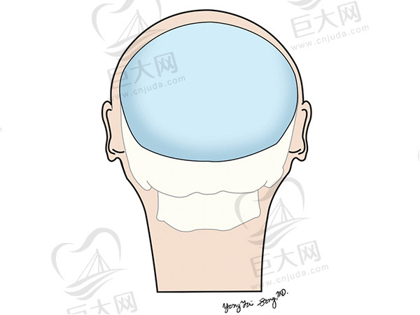 韩国雕刻整形医院宋龙泰院长