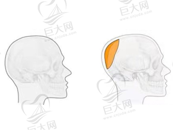 国内后脑勺整形医院医生排名