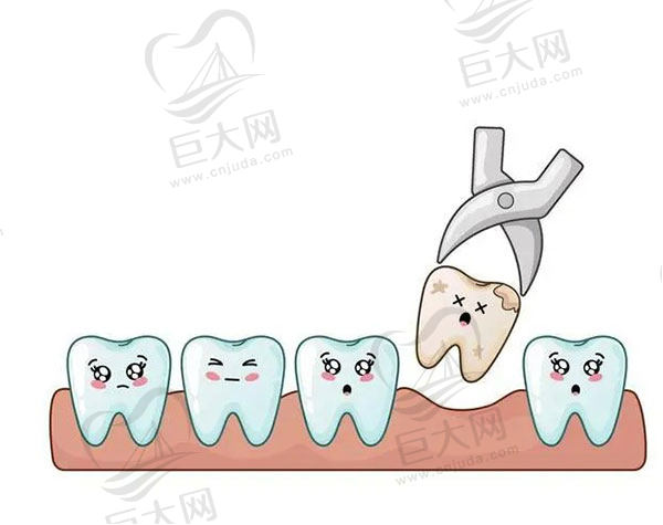 整牙拔牙好还是不拔牙好