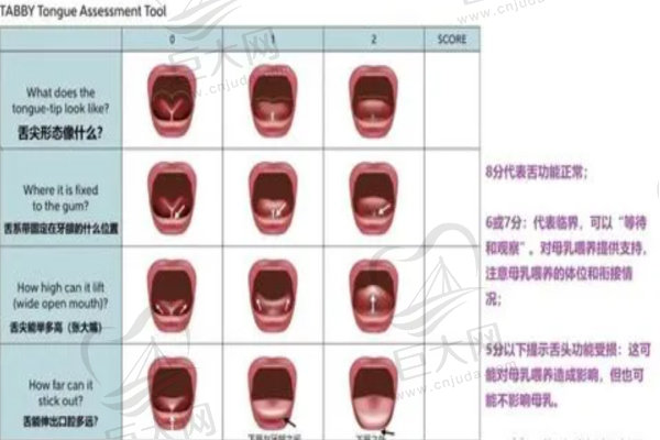 舌系带长短分值对照表