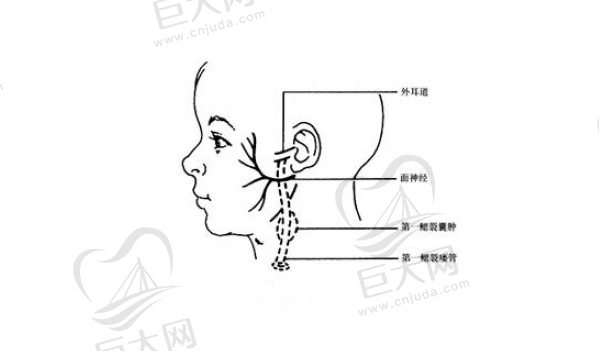 鳃裂囊肿