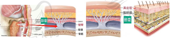 北京高亚东拉皮手术怎么样