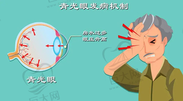 科普青光眼的早期症状6个表现，以及青光眼的发病原因