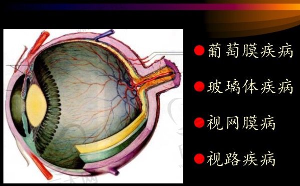 常见的眼底病都有哪些