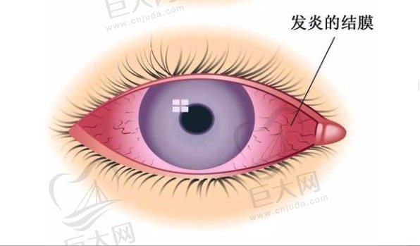 眼表病和眼底病的区别有哪些？