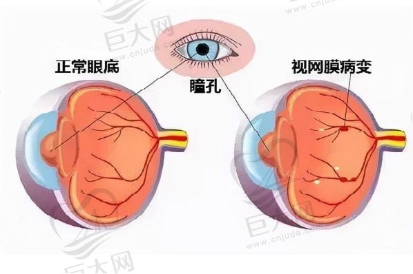 眼表病和眼底病的区别有哪些？