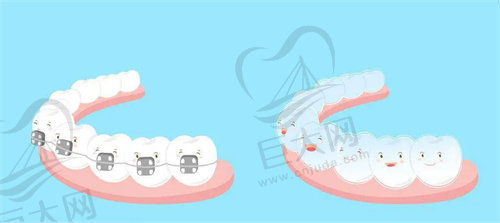 2023年牙齿矫正详解指南