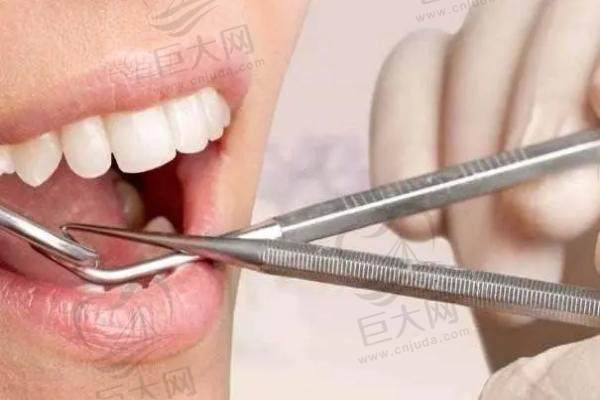 福建漳州呀哚口腔诊疗牙齿