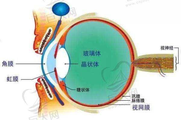 北京明玥眼科医院近视手术图示