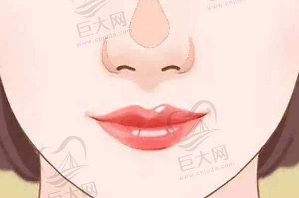 北京美莱美容整形医院鼻部整形收费标准