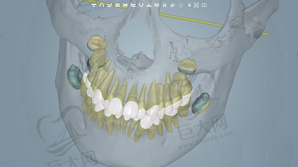 徐宝华正畸私立出诊地点