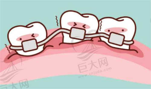 杭州艺星口腔特色手术项目牙齿矫正