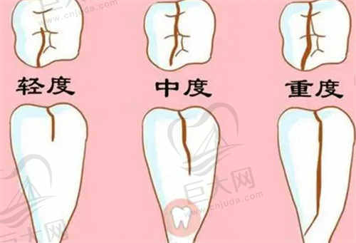 郑州植得口腔医院患者评价