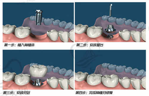 怀集口腔医院怎么样