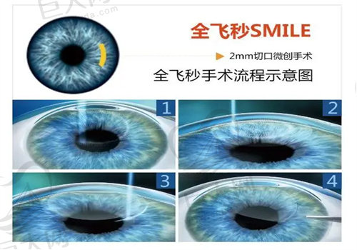 合肥慧视眼科医院怎么样 合肥慧视眼科医院怎么样