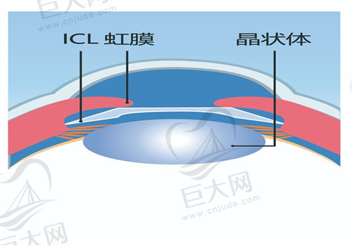 上海华厦柠盟眼科怎么样