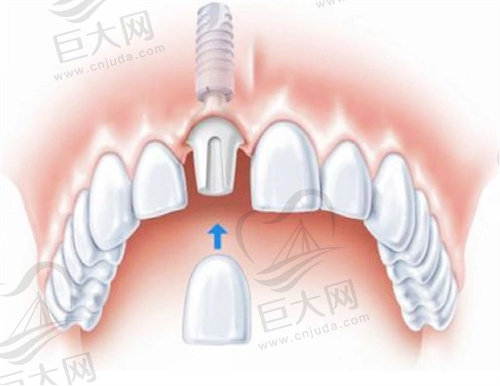 深圳启正口腔门诊部价格表