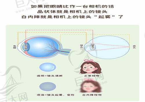 保定新视眼科医院做近视眼手术怎么样