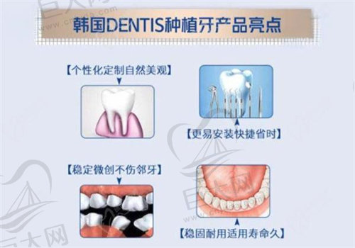 登斯特.jpg